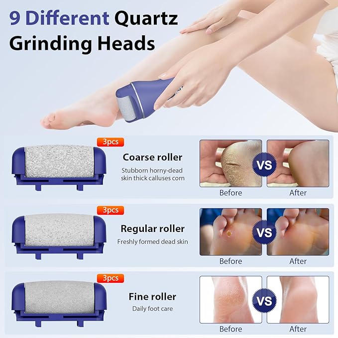 Electric Callus Remover for Feet, Rechargeable Portable Electronic Foot Callus Remover 2-in-1 Wet/Dry Foot Scrubber Electric Toot File for Hard Cracked Dry Dead Skin(Blue)