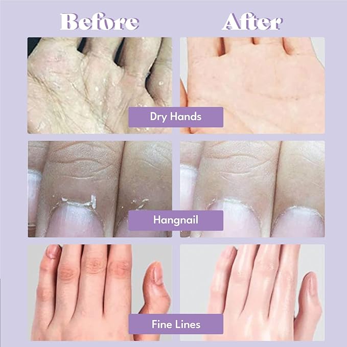 Extra Silky Hand Mask 5 Pairs, Korean Moisturizing Gloves for Dry Hands with White Truffle, Green Caviar & Peptides, Repairing Hand Care Treatment for Aging, Cracked, and Dry Skin, Stocking Stuffer