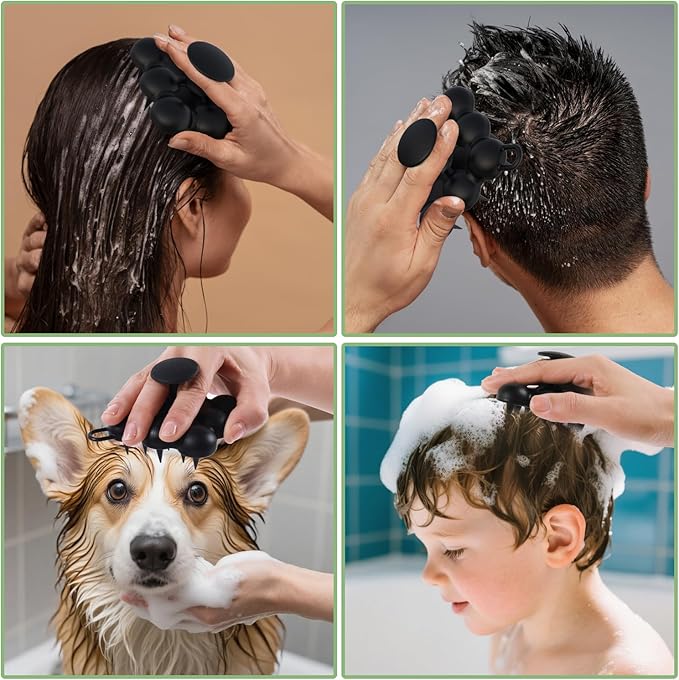 Silicone Scalp Massager Shampoo Brush for Hair Growth, Dandruff Removal & Wet/Dry Care, Hair Scrubber Scalp Stimulator Exfoliator Brush with Soft Bristles for Men & Women, Black