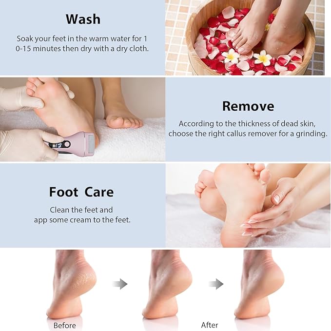 Electric Callus Remover for Feet, Rechargeable Portable Electronic Foot Callus Remover 2-in-1 Wet/Dry Foot Scrubber Electric Toot File for Hard Cracked Dry Dead Skin（Pink）