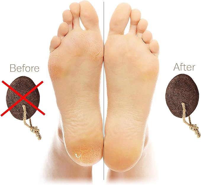 Pumice Stone - Natural Earth Lava Brown - Callus Corn Remover for Feet Heels and Palm - Pedicure Exfoliation Tool - Dry Dead Skin Scrubber - Health Foot Care